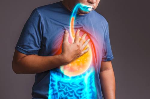 Tratamiento Médico Quirúrgico Enfermedad Diverticular